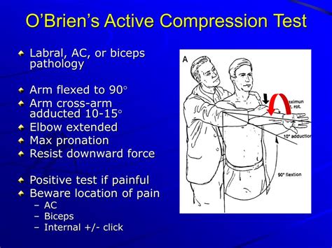 active compression test labral tear|labral tear vs clicking sound.